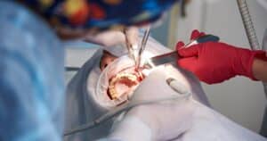 traveling after dental surgery